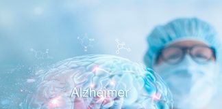 Conoce todo sobre el alzheimer en salud y cuidado